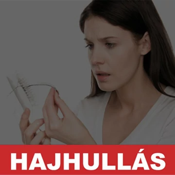 Vess véget a hajhullásnak!